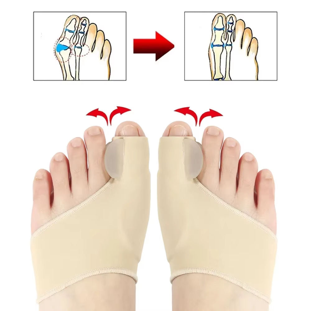 Silikonska opora za palec – Hallux Valgus